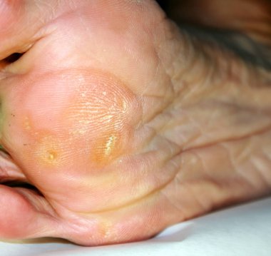 Mısır yürüyerek. Ayak Mısır ile tek