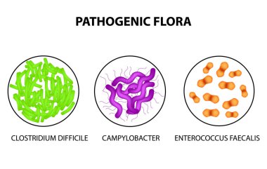 Pathogenic flora. Clostridium difficile, Campylobacter, Enterococcus faecalis. Infographics. Vector illustration on isolated background. clipart