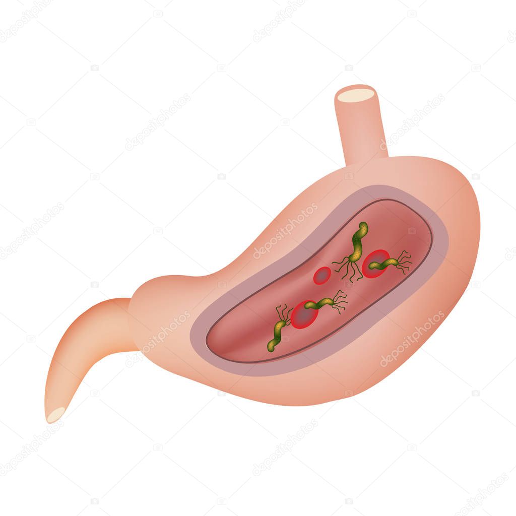 Stomach. Helicobacter pylori. Vector illustration on isolated background.