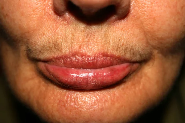 Labbra femminili con i baffi sul labbro superiore. Depilazione sul viso. Depilazione . — Foto Stock