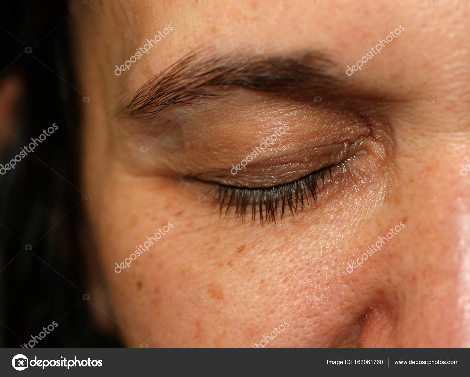 eyelid wrinkles