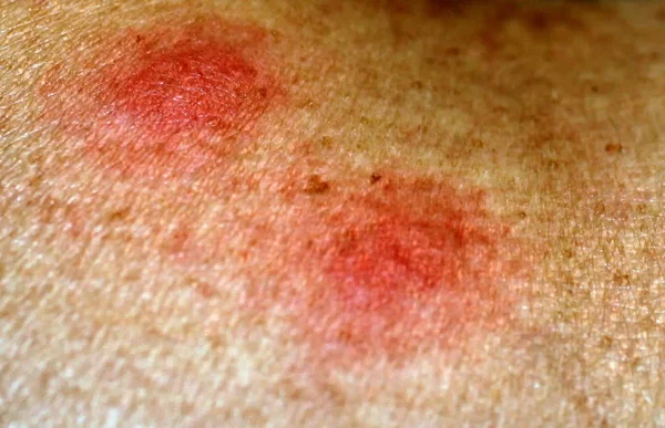 Dmitrovdagi guruh jinsiy aloqa