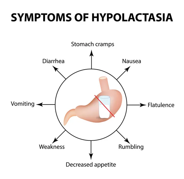 Síntomas de hipolactasia. Intolerancia a la lactosa. Infografías. Ilustración vectorial sobre fondo aislado — Vector de stock
