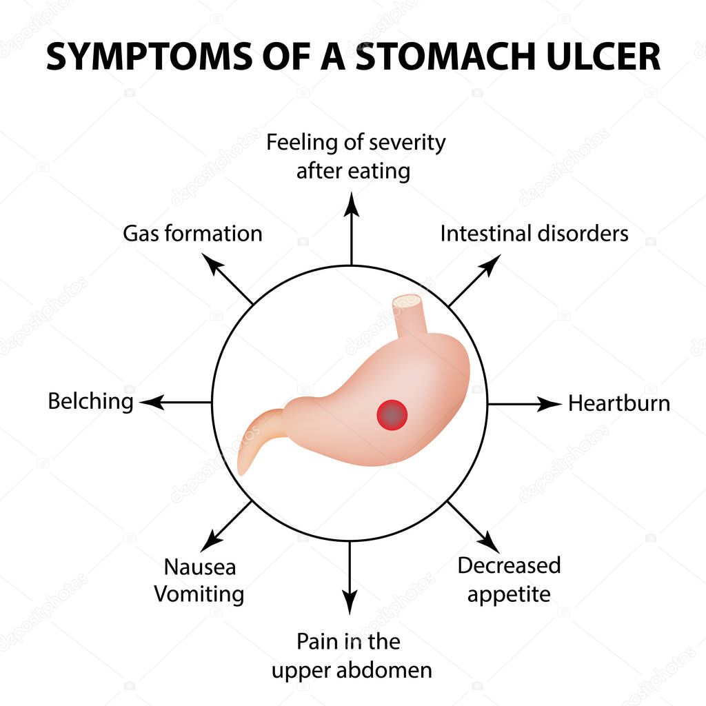 Symptoms of a stomach ulcer. Infographics. Vector illustration on isolated background