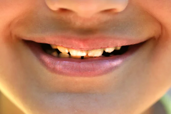 Niño sonriente con dientes. Brillantes labios hermosos —  Fotos de Stock