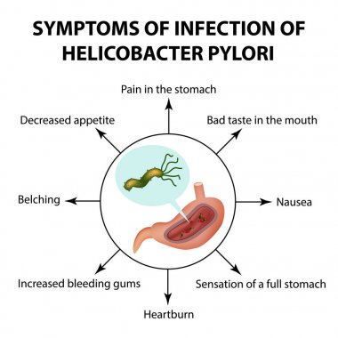 Helicobacter pylori enfeksiyonu belirtileri. Infographics. Vektör illüstrasyon izole arka plan üzerinde