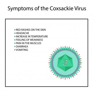 Coxsackie virüs enfeksiyonu belirtileri. Enterovirüslerin. Infographics. Vektör illüstrasyon izole arka plan üzerinde