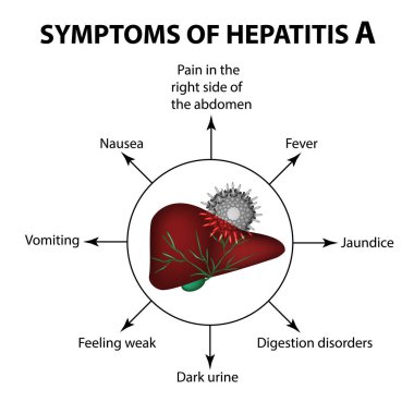 Hepatit A. karaciğer belirtileri. Virüs. Infographics. Vektör illüstrasyon izole arka plan üzerinde.