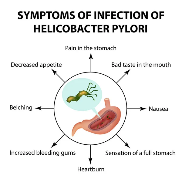 Síntomas de infección de Helicobacter pylori. Infografías. Ilustración vectorial sobre fondo aislado — Vector de stock