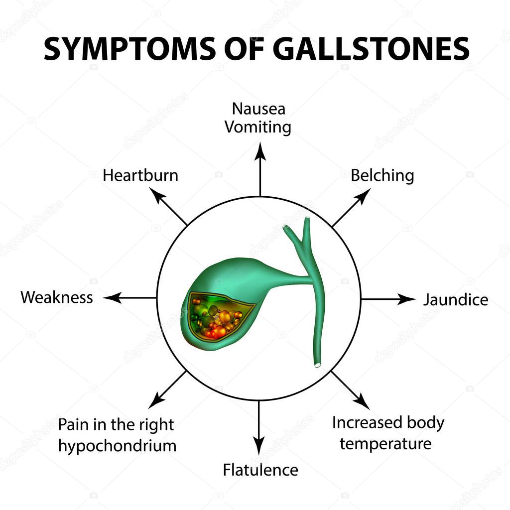 Symptoms of stones in the gallbladder. Infographics. Vector illustration on isolated background