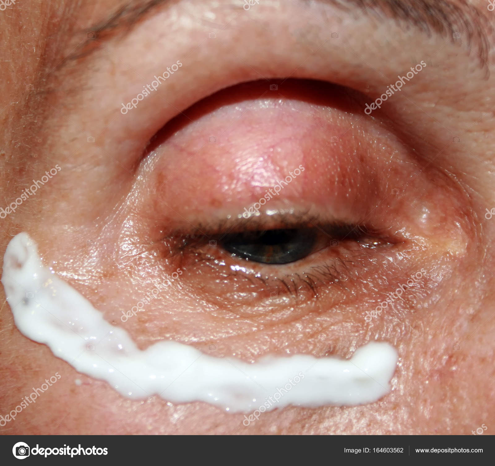 eyelid wrinkle cream