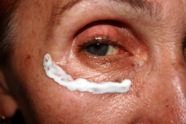 Gözlerinin altında Kırışıklık krem uygulama. Göz kapağı kırışıklıkları.