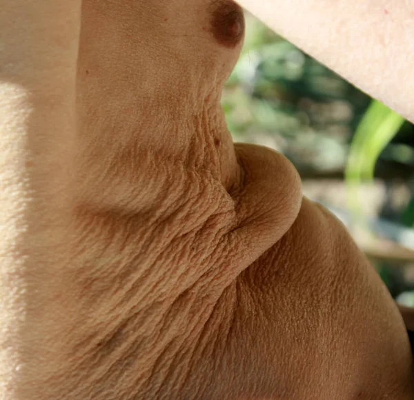 Πλαδαρό δέρμα. Διπλώστε το δέρμα στην κοιλιά και στο στήθος — Φωτογραφία Αρχείου