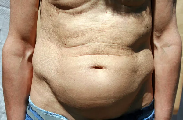 Duży brzuch mężczyzny — Zdjęcie stockowe