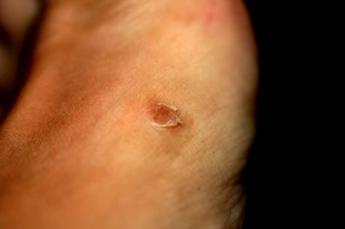 Mısır cilt üzerinde. Mısır haşhaş.