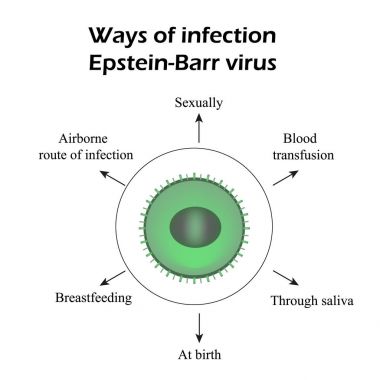 Epstein - Barr virüsü. Enfeksiyon yöntemleri. Infographics. Vektör çizim