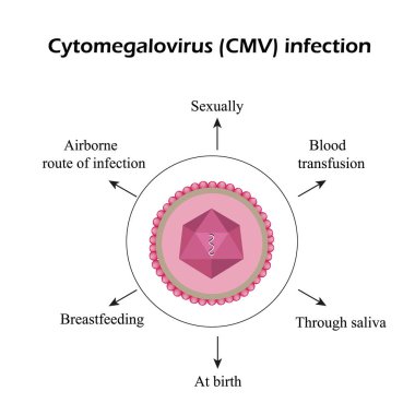 Cytomegalovirus. Diseases caused by cytomegalovirus. Infographics. Vector illustration clipart
