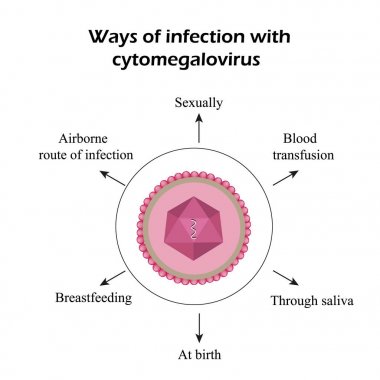 Sitomegalovirüs. Sitomegalovirüs tarafından neden olduğu hastalıklar. Infographics. Vektör çizim