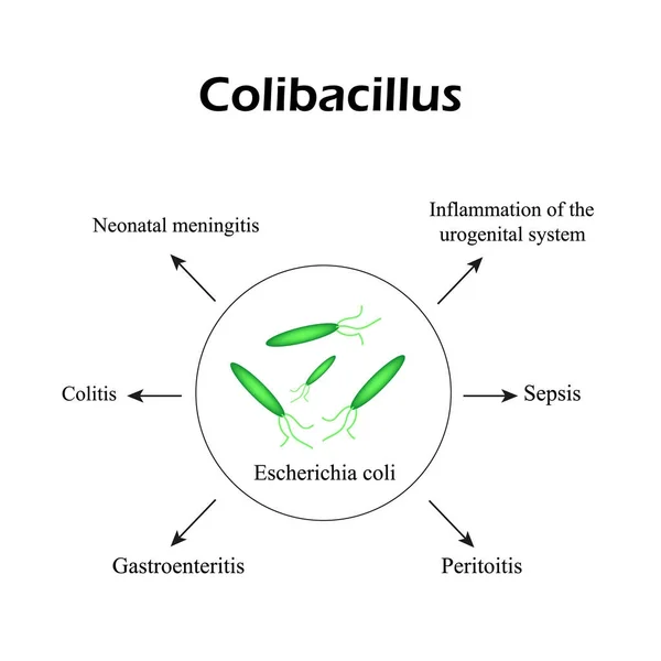 E. coli. Enfermedades que causan E. coli. Infografías. Ilustración vectorial — Archivo Imágenes Vectoriales