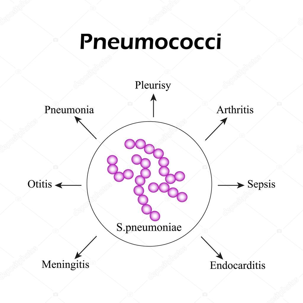 Pneumococci. Pneumococcal diseases. Infographics. Vector illustration