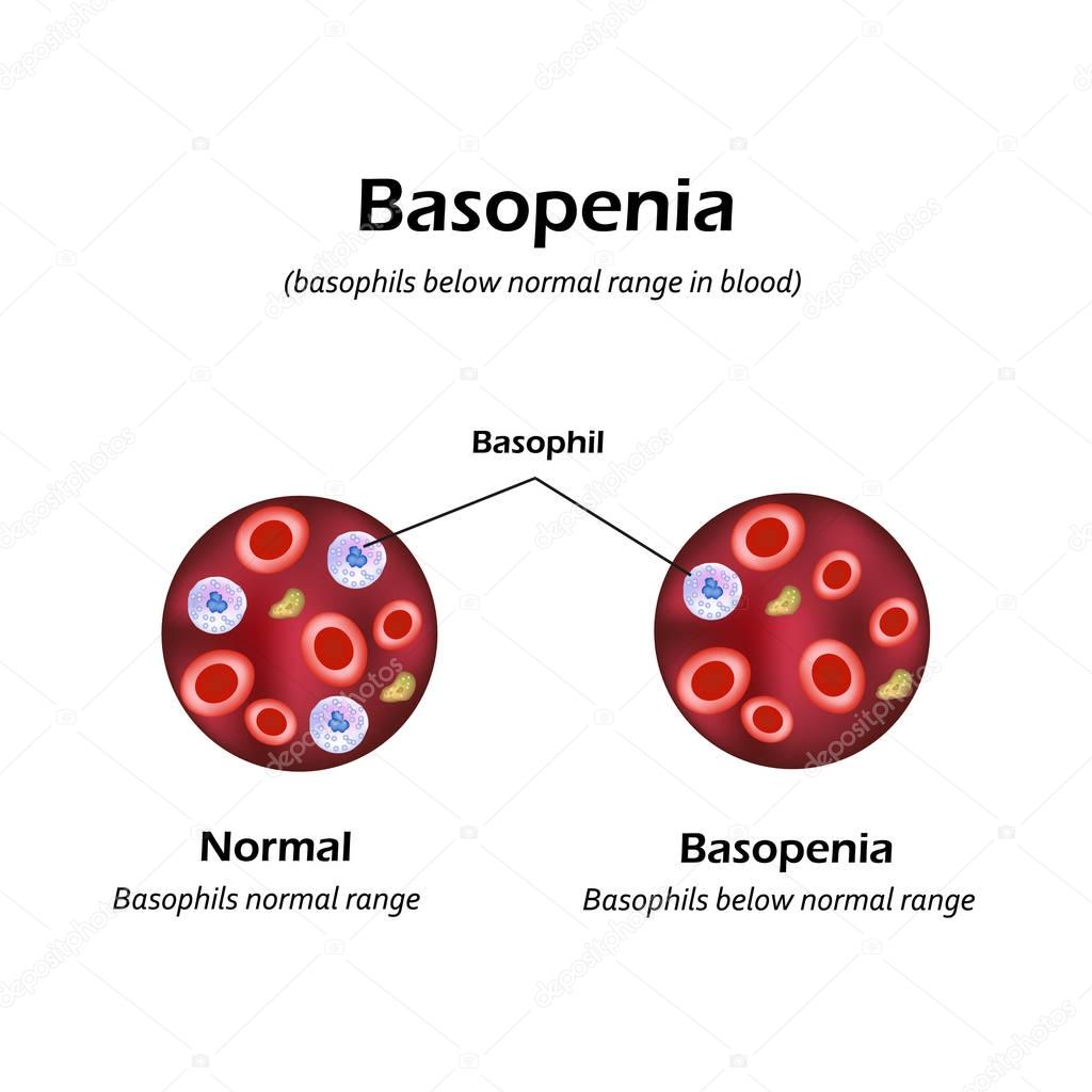 Basophils below the normal range in the blood. Basopenia. Infographics. Vector illustration