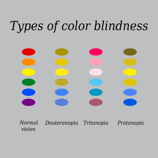 Types of color blindness. Eye color perception. Vector illustration on