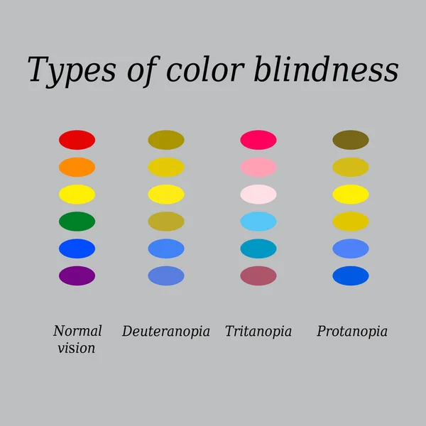 Tipos de daltonismo. A percepção da cor dos olhos. Ilustração vetorial sobre fundo cinzento — Vetor de Stock
