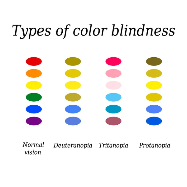 Typy ślepoty kolor. Oko postrzegania kolorów. Ilustracja wektorowa na na białym tle — Wektor stockowy
