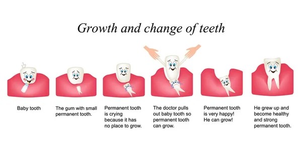 Wachstum und Verschiebung der Zähne beim Menschen. Entwicklungsstadien der Zähne. Kinder multiplekatsionny Stil. Infografiken. Vektor-Illustration auf isoliertem Hintergrund — Stockvektor