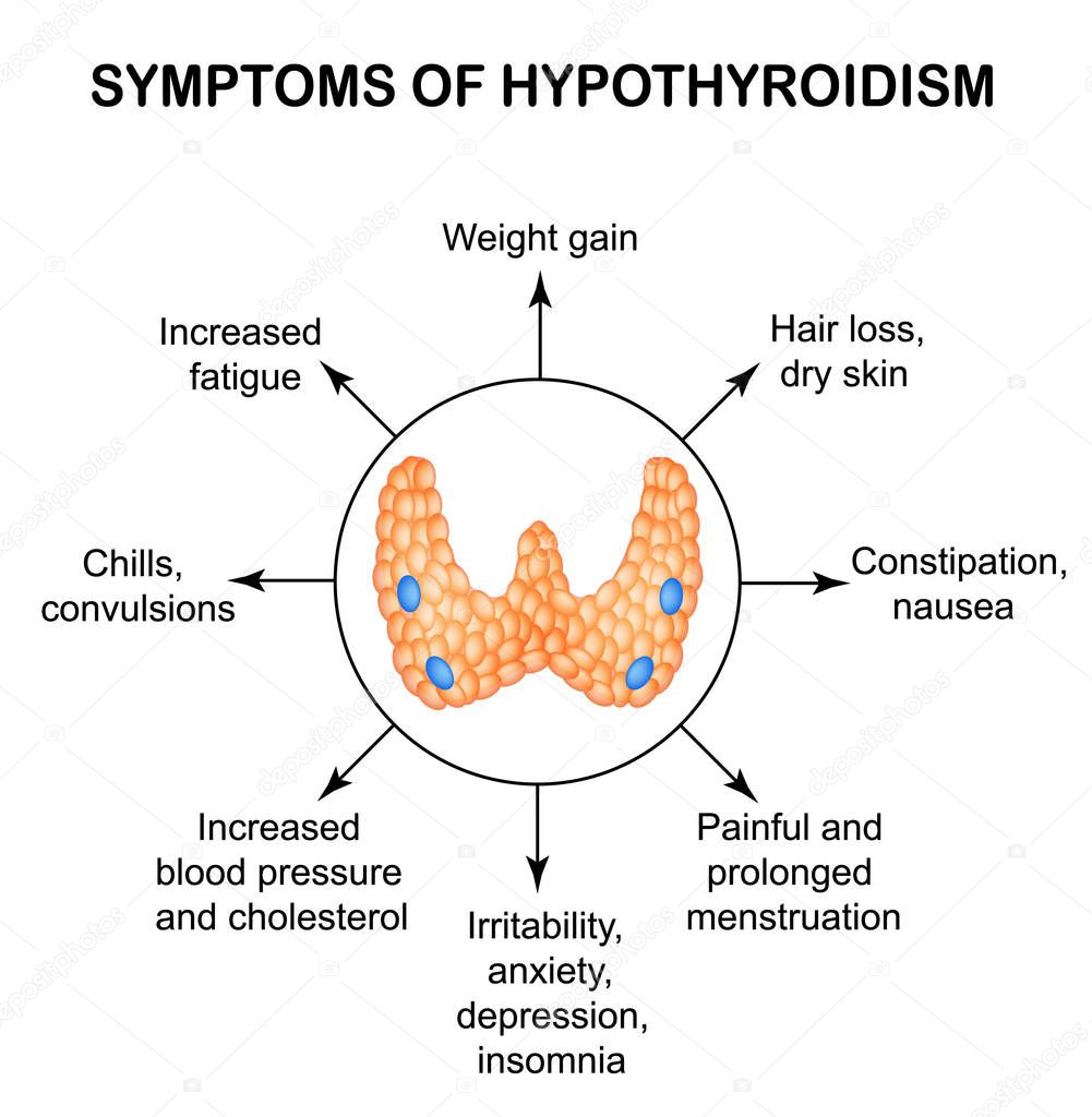 Symptoms of hypothyroidism. Thyroid. Infographics. Vector illustration on isolated background.