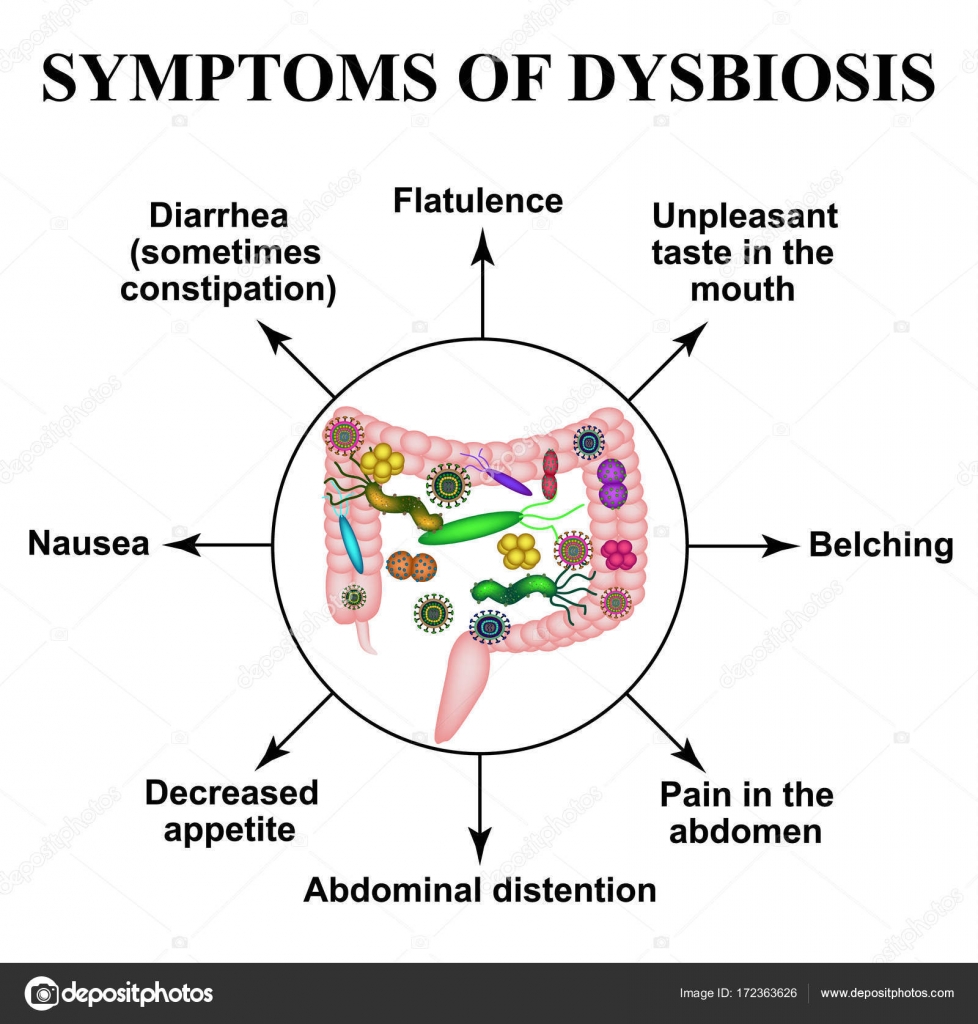 Vastagbél dysbiosis