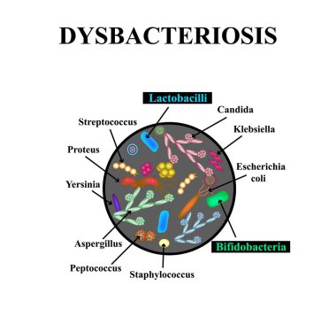 Bağırsak Dysbacteriosis. Lactobacillus, bifidobakteri, streptokok, Staphylococcus, E. coli, Aspergyllus mantar, Candida. Infographics. Vektör illüstrasyon izole arka plan üzerinde.