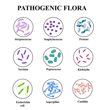 Pathogenic flora in the intestine. colon. infographics. Vector illustration on isolated background. clipart