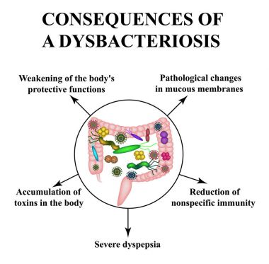 Consequences of intestinal dysbiosis. Dysbacteriosis of the colon Infographics. Vector illustration on isolated background. clipart