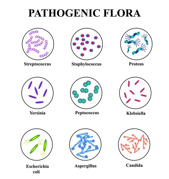 Flora patógena en el intestino. colon. infografías. Ilustración vectorial sobre fondo aislado . — Vector de stock