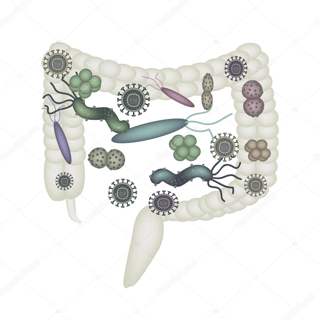 Dysbacteriosis of the intestine. Colon. dysbiosis of colon. Bacteria, fungi, viruses. Infographics. Vector illustration on isolated background.