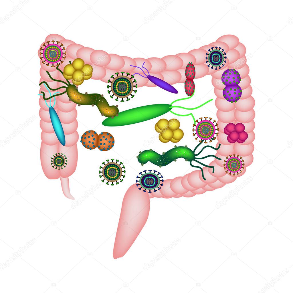 Dysbacteriosis of the intestine. Colon. dysbiosis of colon. Bacteria, fungi, viruses. Infographics. Vector illustration on isolated background.