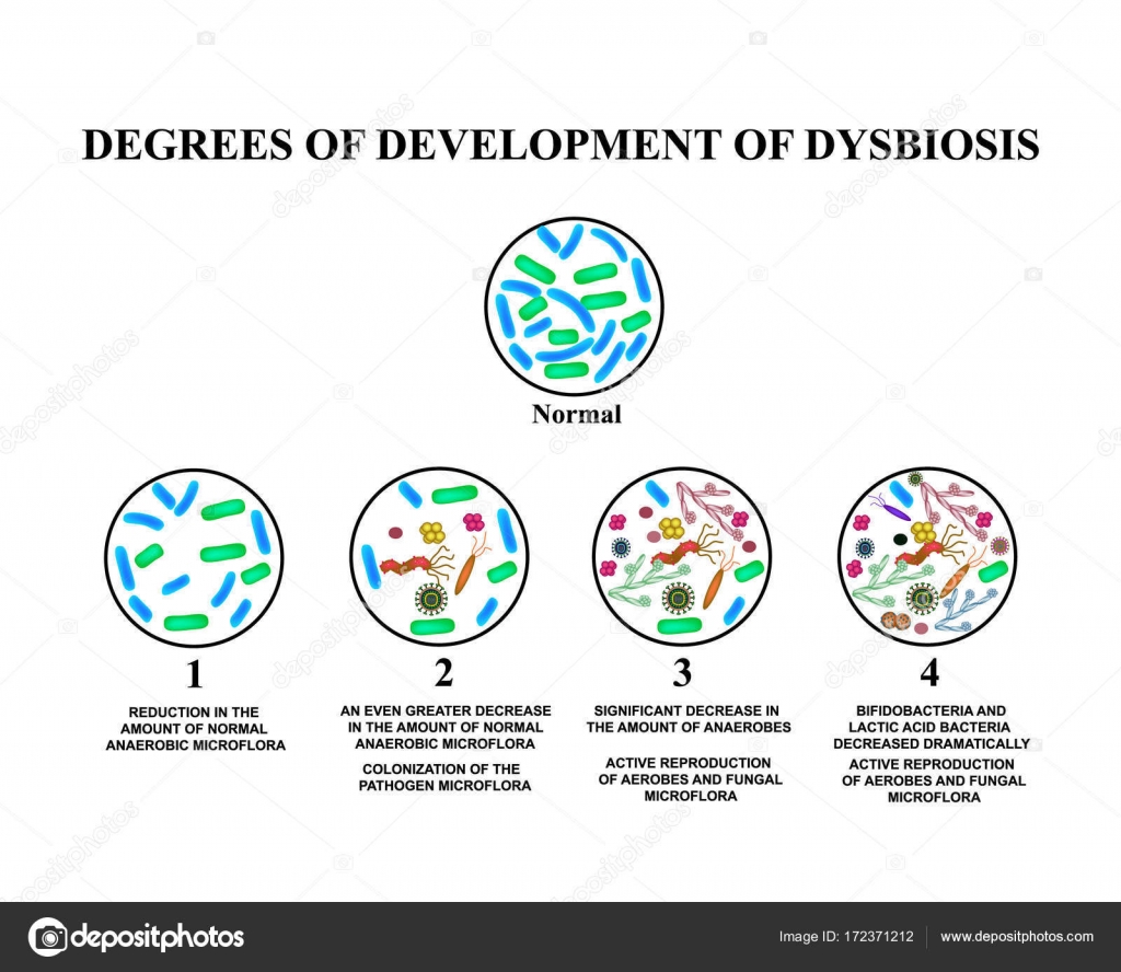 Image result for degrees of development of dysbiosis