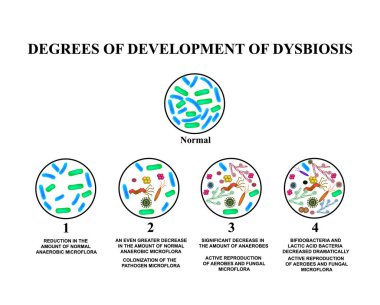 dysbiosis gelişimi 4 derece. Bağırsak Dysbacteriosis. Kalın bağırsak. iki nokta üst üste dysbiosis. Bakteriler, mantarlar, virüsler. Infographics. Vektör illüstrasyon izole arka plan üzerinde.