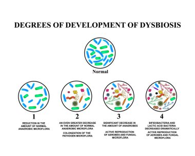 4 degrees of development of dysbiosis. Dysbacteriosis of the intestine. The large intestine. dysbiosis of colon. Bacteria, fungi, viruses. Infographics. Vector illustration on isolated background. clipart