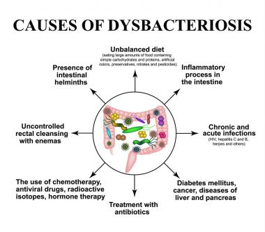 Dysbiosis bağırsak nedenleri. İki nokta üst üste. Bakteri patojenik flora. Infographics. Vektör illüstrasyon izole arka plan üzerinde.