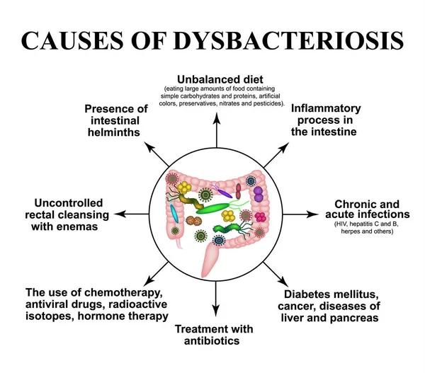 Причины дисбиоза в кишечнике. Кишечник. Бактерии патогенной флоры. Инфографика. Векторная иллюстрация на изолированном фоне . — стоковый вектор