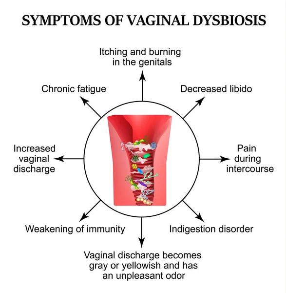 膣に dysbiosis の症状です。膣炎、カンジダ症。Patagene 膣の細菌叢。腸内毒素症。インフォ グラフィック。孤立した背景のベクトル図. — ストックベクタ