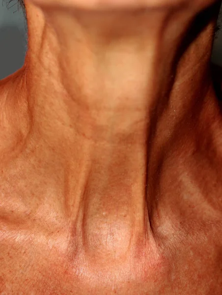 Wrinkles on the neck. Flabby skin on the neck. — Stock Photo, Image