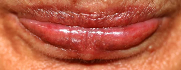 Lips close up. Wrinkles on the lips. Botex of the lips. boteks. — Stock Photo, Image