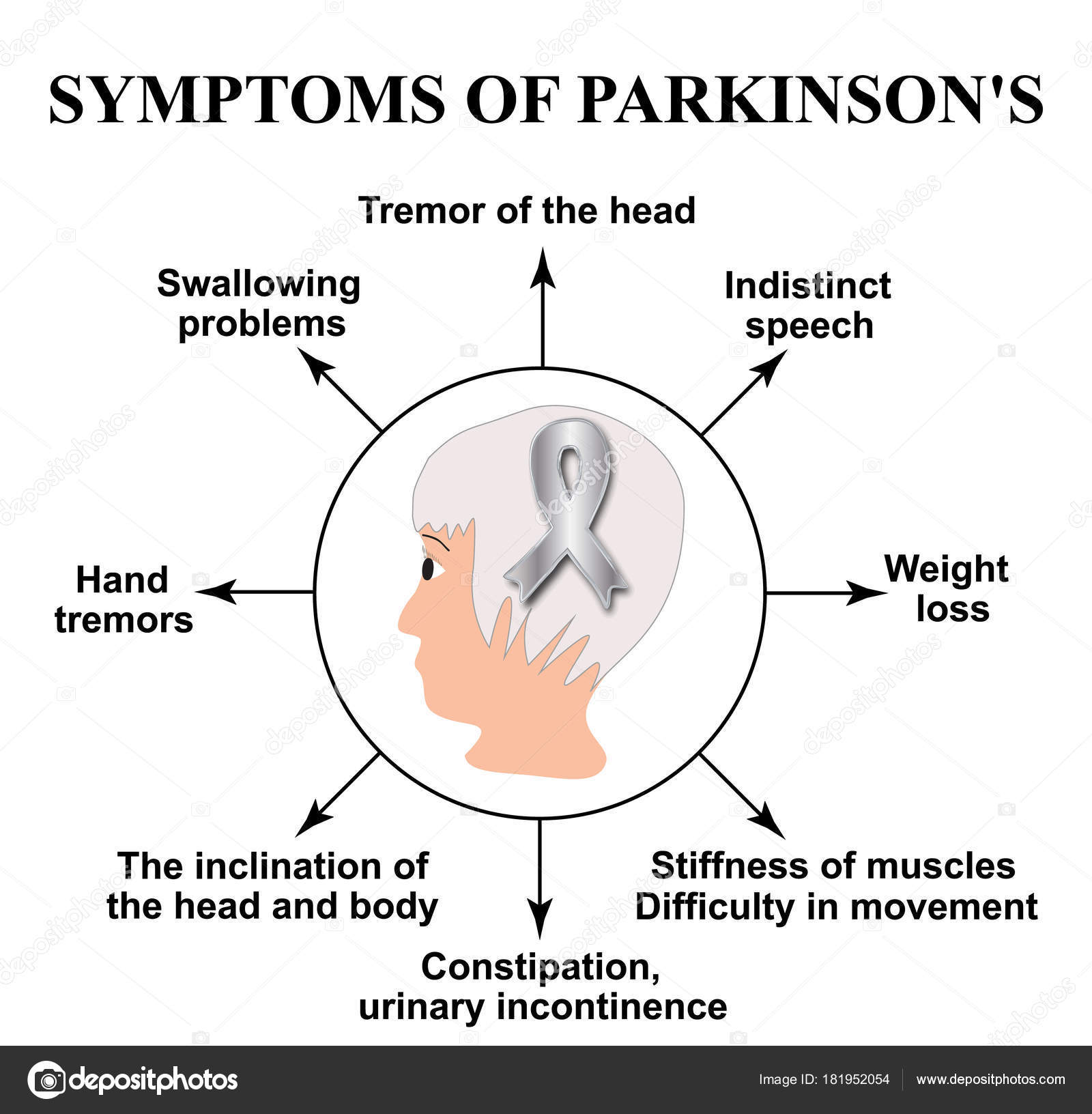 what is etiology of parkinson disease