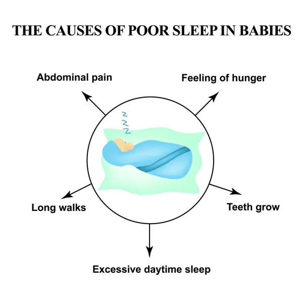 Die Ursachen für schlechten Schlaf bei Säuglingen. Schlaflosigkeit. Weltschlaftag. Schlafkissen. Infografiken. Vektor-Illustration auf isoliertem Hintergrund — Stockvektor