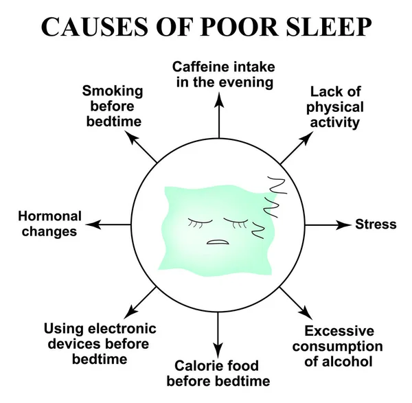 Cause di pessimo sonno. Insonnia. Giornata mondiale del sonno. Cuscino dormiente. Infografica. Illustrazione vettoriale su sfondo isolato — Vettoriale Stock