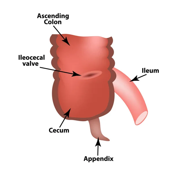 Angolo leocecale. Valvola leocecale. L'ammortizzatore di Bauginiev. L'ileo, il Cecum, l'Appennino. Colon. Infografica. Illustrazione vettoriale su sfondo isolato . — Vettoriale Stock