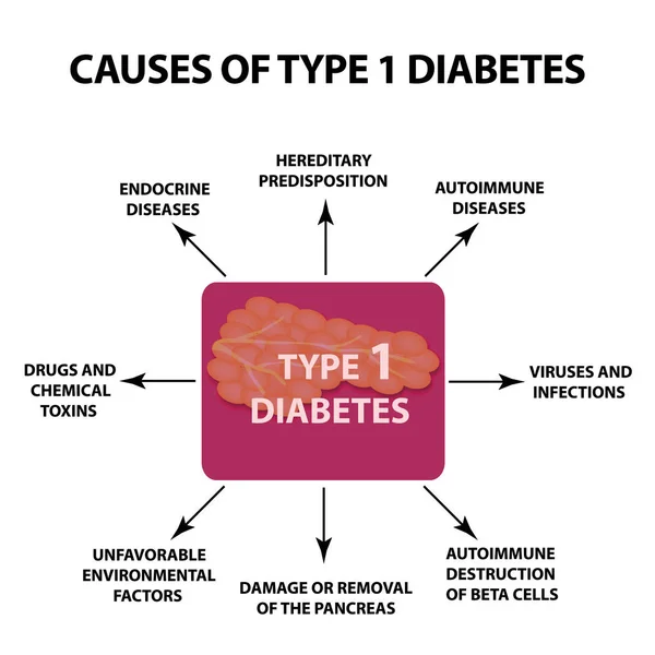 Le cause del diabete di tipo 1. Infografica. Illustrazione vettoriale su sfondo isolato . — Vettoriale Stock